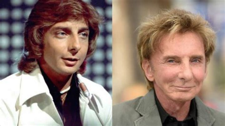 Barry Manilow’s Plastic Surgery: The Mandy Singer Has Denied Getting Cosmetic Surgery!