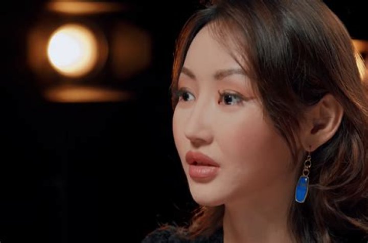 Did Yeonmi Park Had A Plastic Surgery? Is She Fake? Husband, Son And Instagram