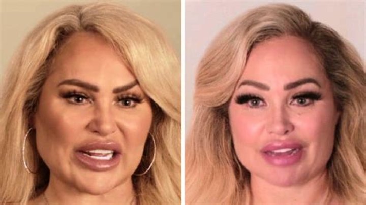 Pictures: Darcey And Stacey Before And After Plastic Surgery? Parents Nationality & Ethnicity