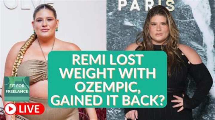 Remi Bader’s Weight Loss: The Use of Ozempic Drug and its Consequences; Check Out the TikToker’s Before and After Pictures!