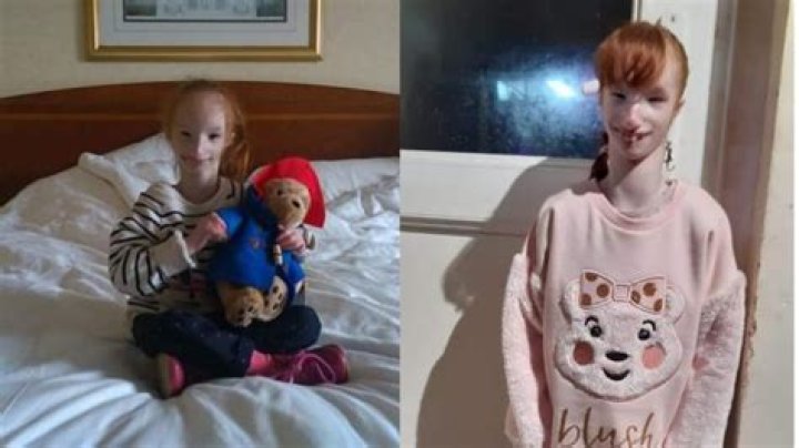Who Is Charlotte Garside? Is Worlds Smallest Girl Dead or Alive? Wikipedia Update